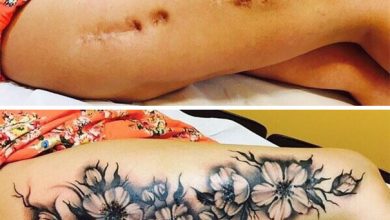 Knee scar tattoo ideas